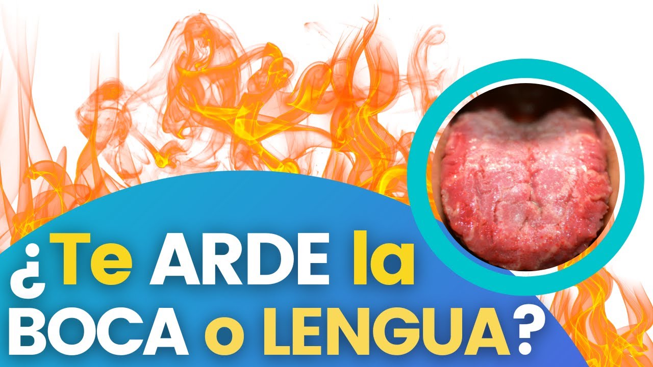 como aliviar ardor en la boca