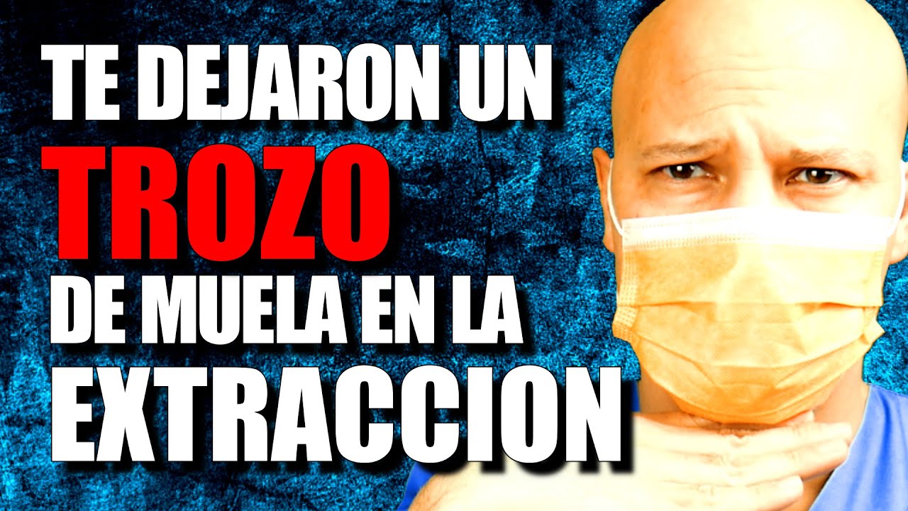 duele quitar la raíz de una muela