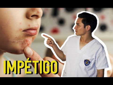 granitos alrededor de la boca niños 4 años