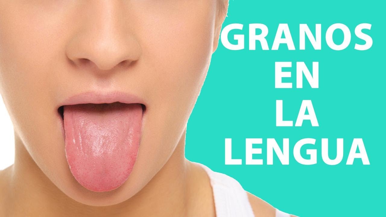 granitos en la lengua que duelen