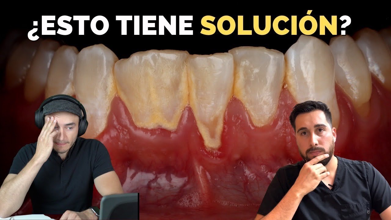 porque me sangran las encías y tengo mal aliento