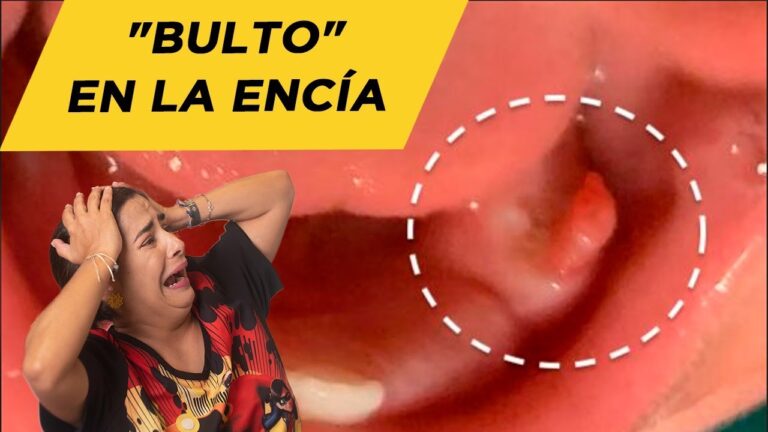 qu-hacer-si-tu-beb-tiene-una-bolita-de-carne-en-la-enc-a-consejos-y