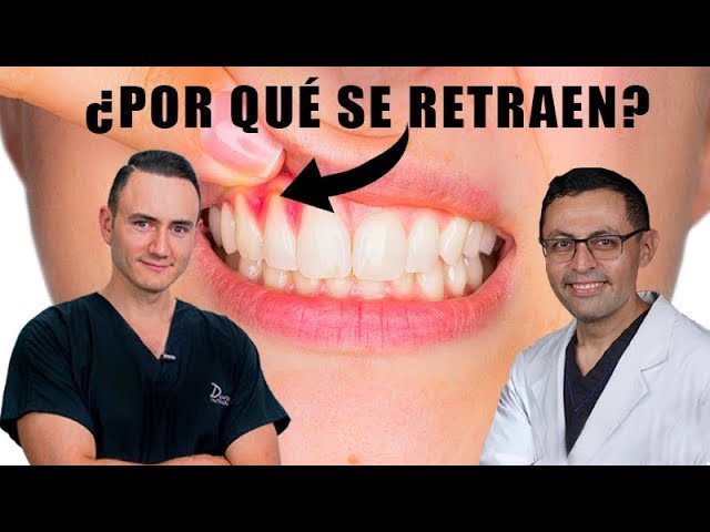 por que se retraen las encias